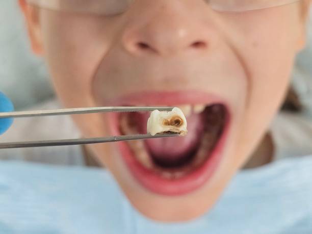 Best Same-Day Emergency Dental Services in Pemberville, OH